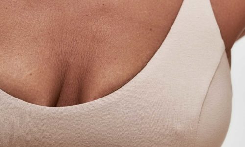 Rejuvenecimiento mamario o mastopexia en madrid