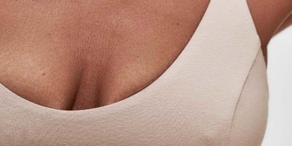 Rejuvenecimiento mamario o mastopexia en madrid