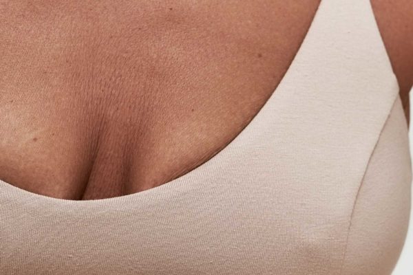 Recuperación de mastopexia: cuidados y tiempos