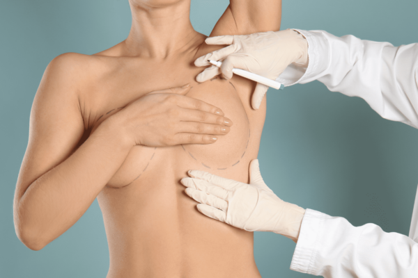 Aumento de pecho por la areola: técnica, ventajas y recuperación